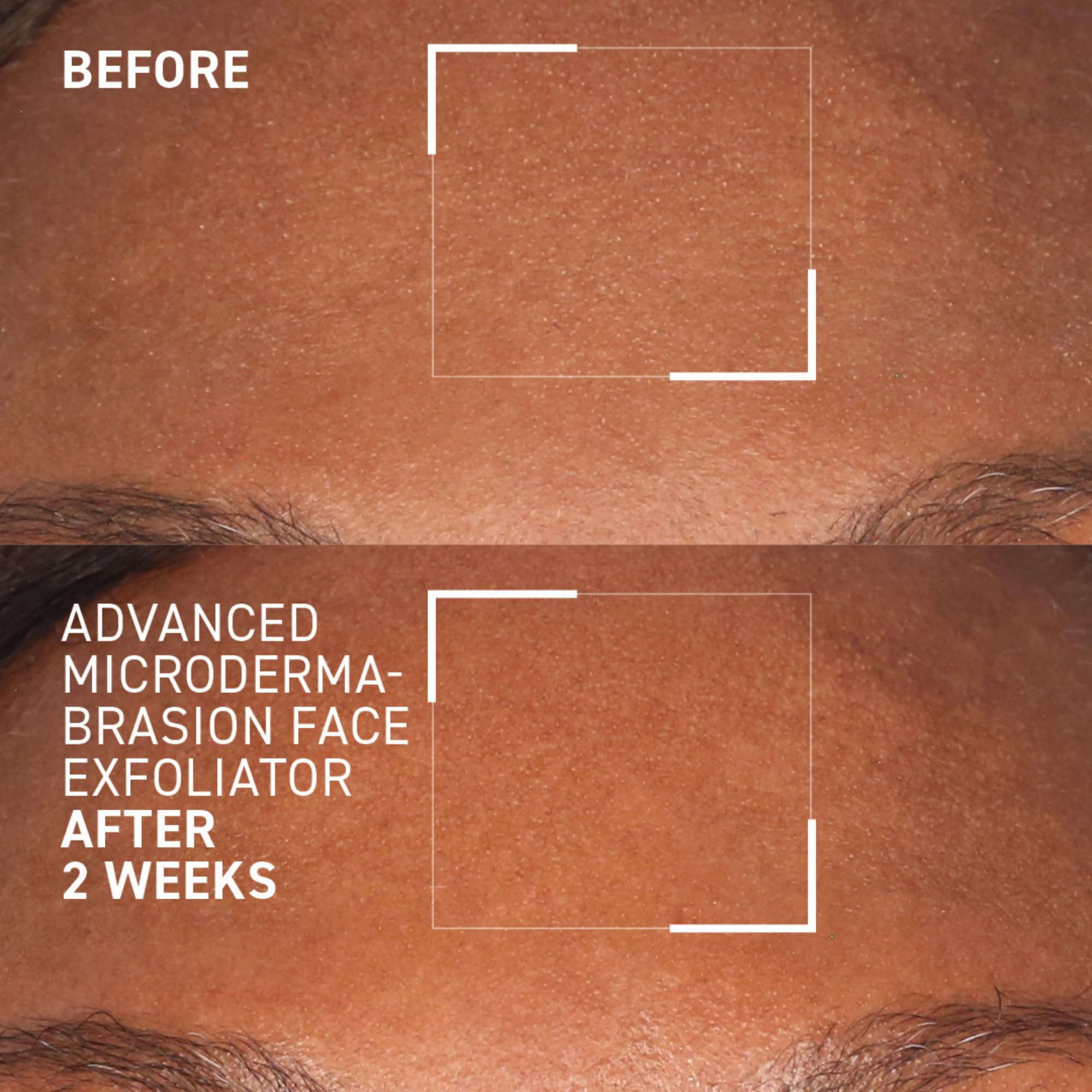 Dr. Brandt Advanced Microdermabrasion Face Exfoliator – Refines Texture & Evens Skin Tone | 2 oz