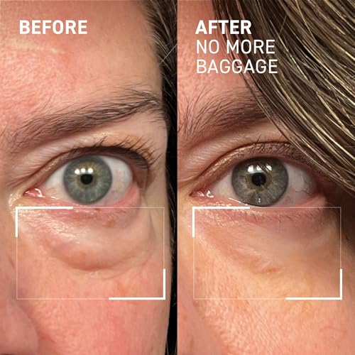 Dr. Brandt Needles No More Baggage – 0.5 oz x2 Eye Gel Minimizes Puffiness & Dark Circles