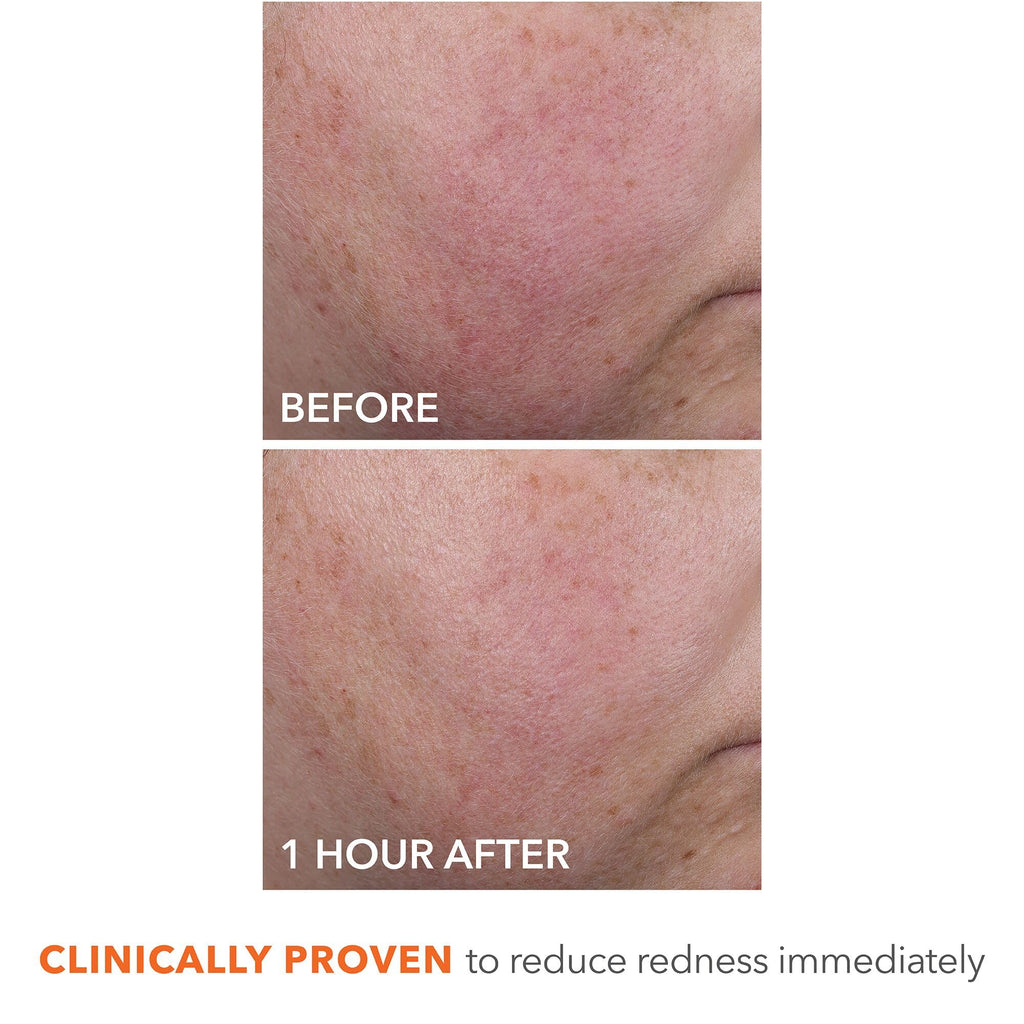 Dr Dennis Gross DermInfusions Blur + Repair Cream – Instant Blur, Satin-Matte Finish, Hydration