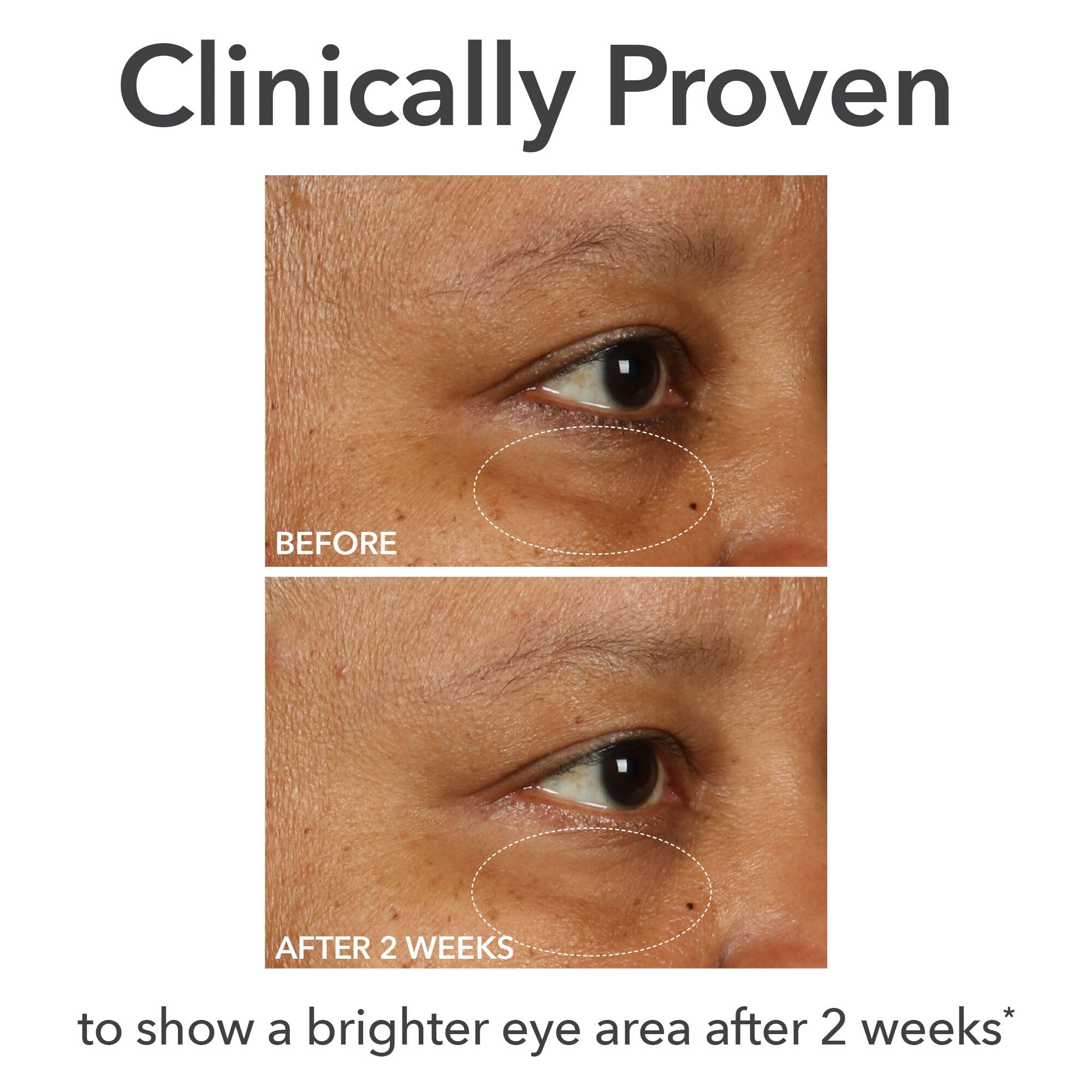 Dr Dennis Gross DermInfusions Fill + Repair Eye Cream – Hydrating & Brightening, 0.5 oz