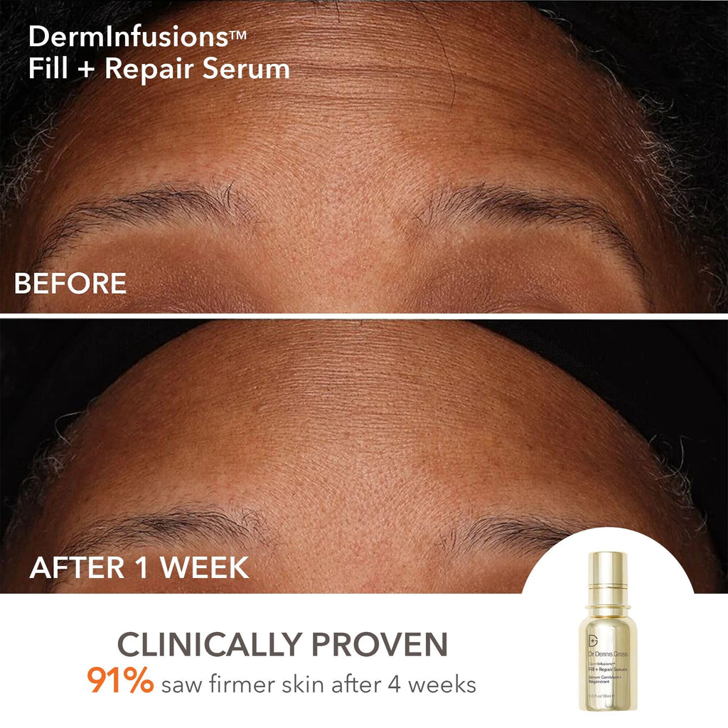 Dr Dennis Gross DermInfusions Discovery Kit – Plump, Fill & Repair Skincare Set