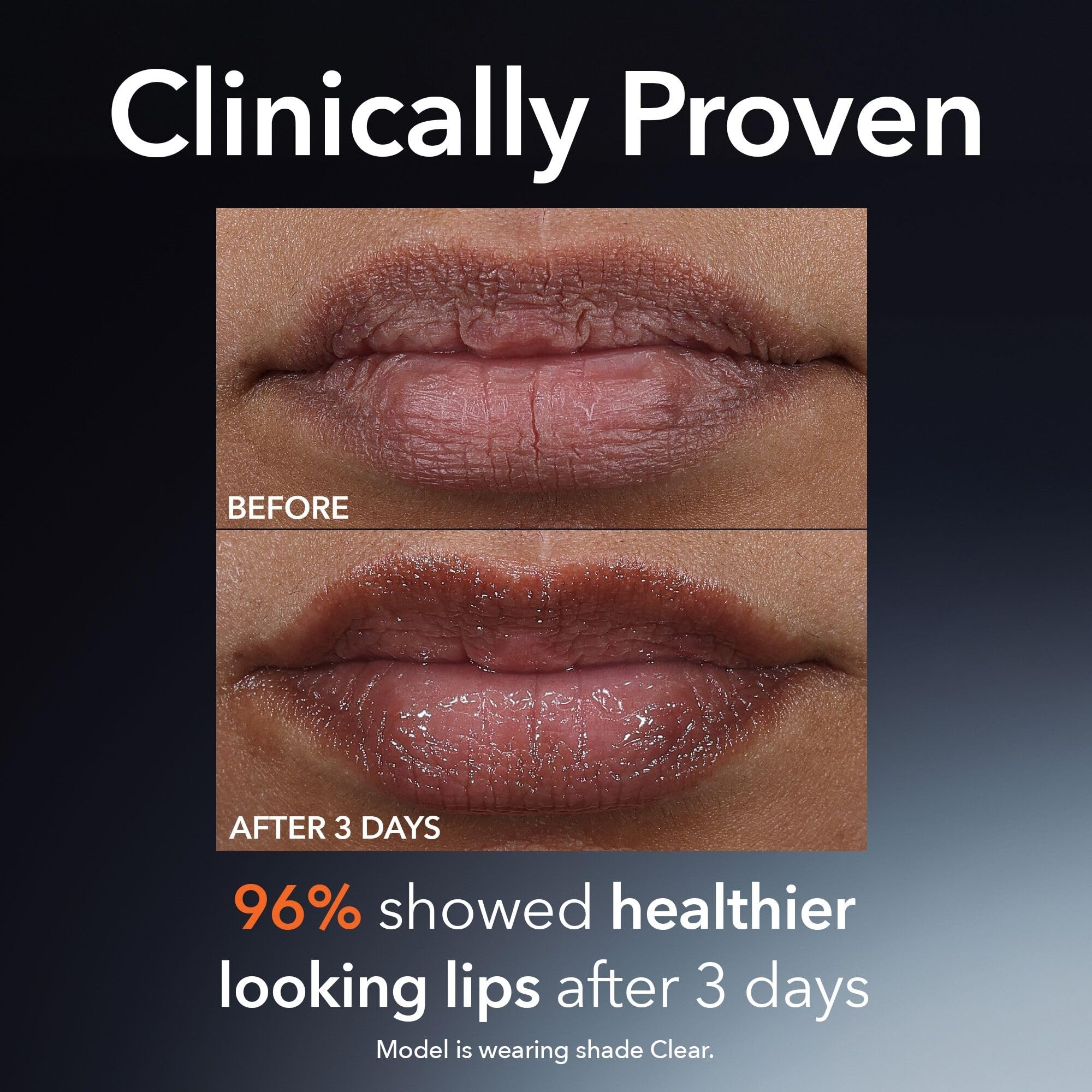 Dr Dennis Gross DermInfusions Plump + Repair Lip Treatment Clear – Hyaluronic Acid, Peptides, Barrier Repair