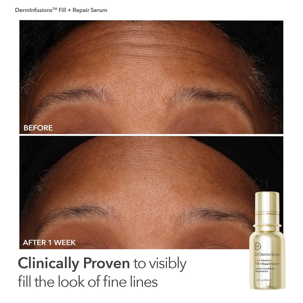 Dr Dennis Gross Fill, Plump & Firm Kit | DermInfusions Hyaluronic Serum, Eye & Lip