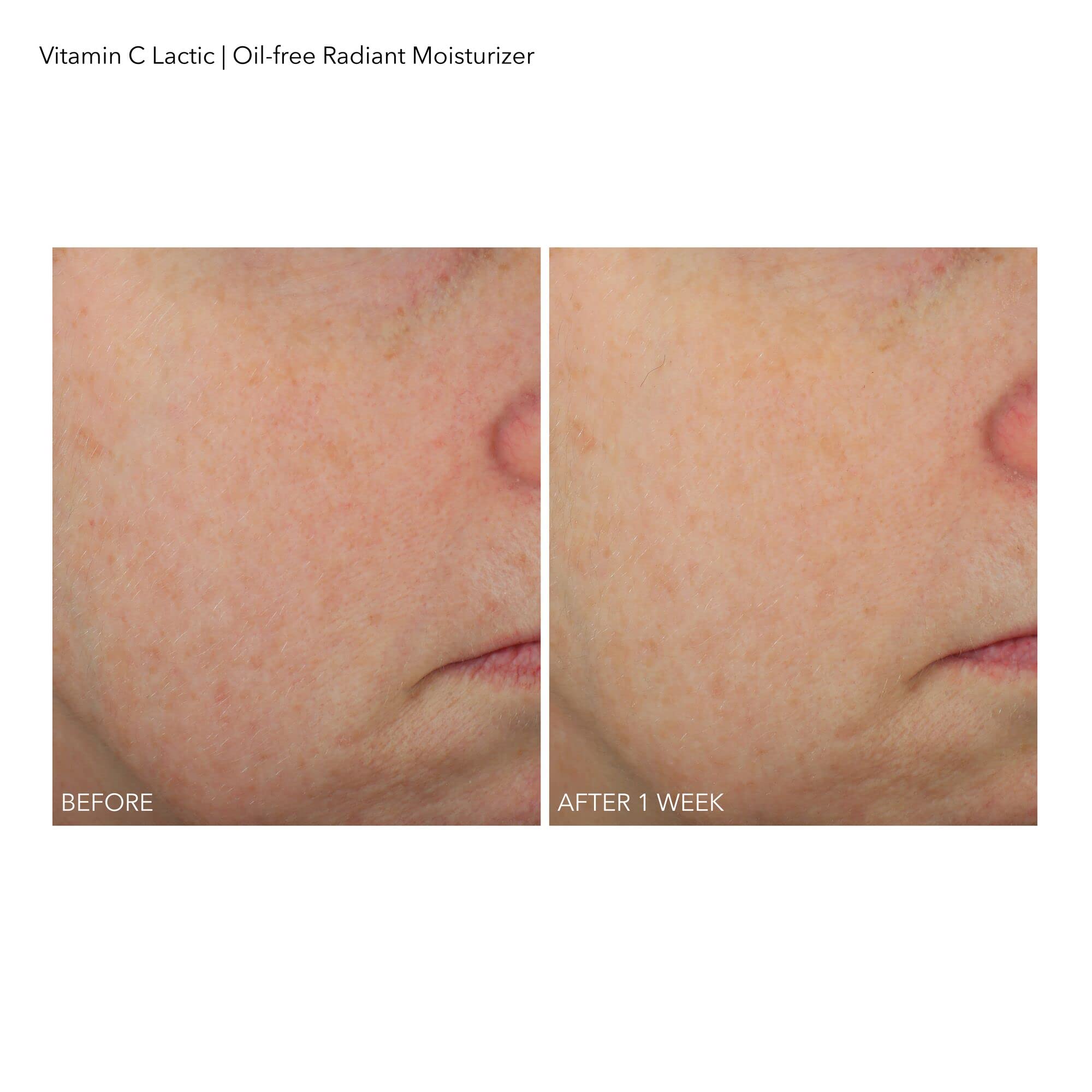 Dr Dennis Gross VitC+Lactic Oil-Free Radiant Moisturizer - 1.7 fl oz / 50 ml