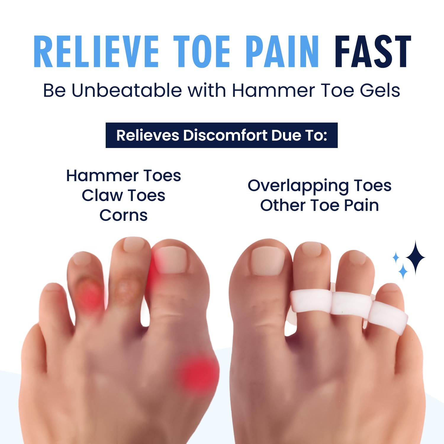 Dr. Frederick's Original Hammer Toe Corrector Gels – 2 Pairs for All-Day Toe Alignment
