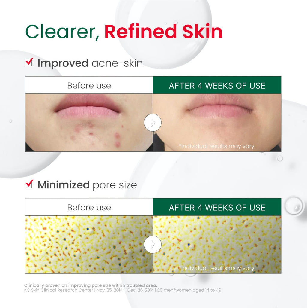 Dr. G R.E.D. Blemish Clear Hyal-Cica Serum – Hydration with Hyaluronic Acid & Centella, 1.69 fl oz
