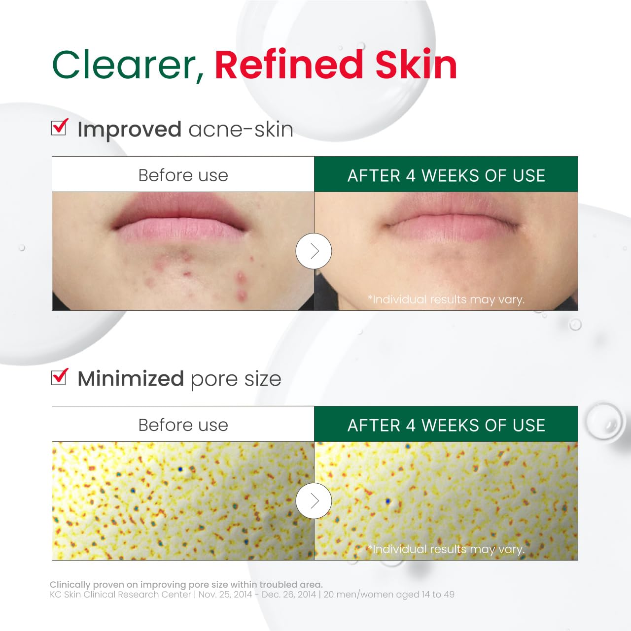 Dr. G R.E.D. Blemish Clear Hyal-Cica Serum – Hydration with Hyaluronic Acid & Centella, 1.69 fl oz