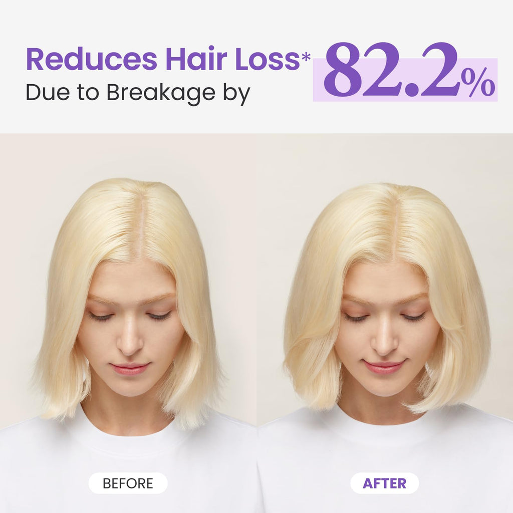 Dr.Groot Rosemary Mint Oil Tonic – Hair Growth with Biotin & Hyaluronic