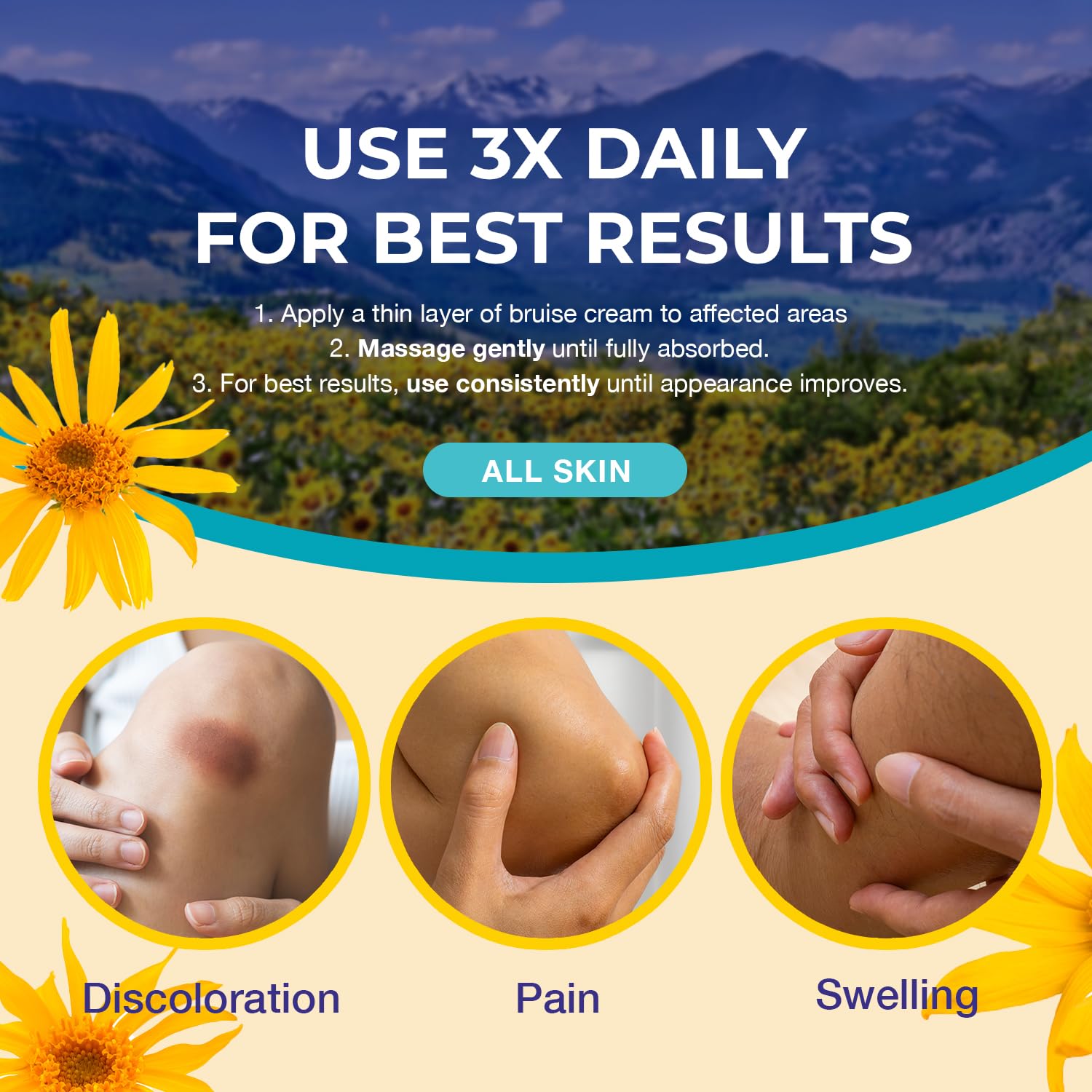 Dr. Luke Arnica Bruise Cream Extra Strength – Fast Relief for Bruising, Swelling & Discoloration