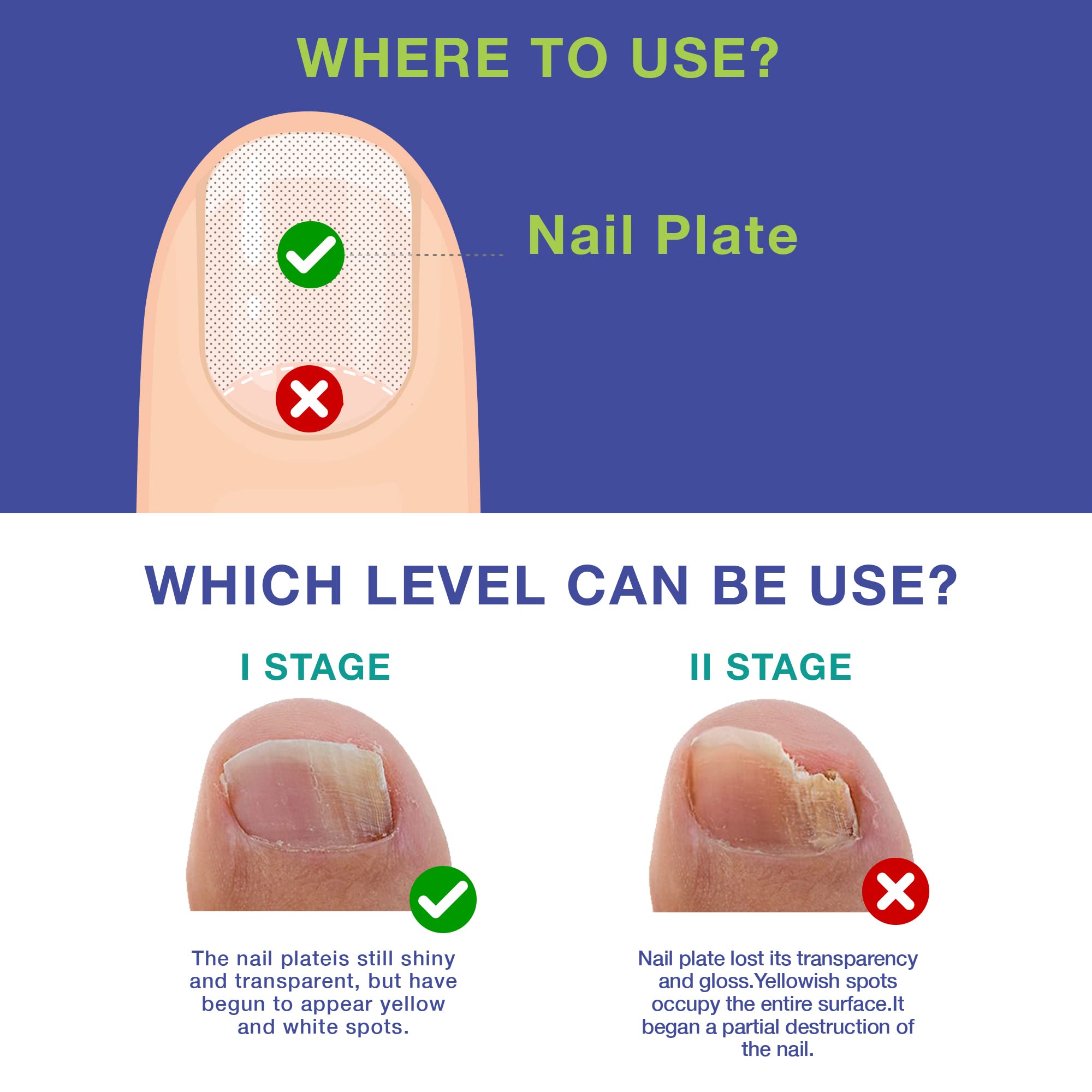 Dr. Luke Nail Repair Liquid – Restorative Nail & Cuticle Care (1 oz, Packaging May Vary)