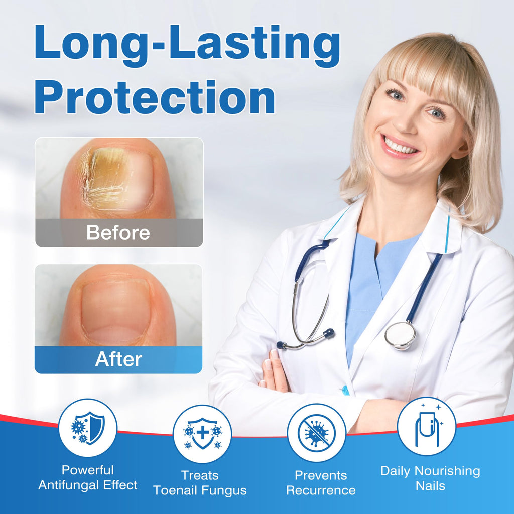 DR.RAPID Toenail Fungus Treatment Pen Extra Strength – 25% Undecylenic Acid & Terbinafine (5ml, 3 Pcs)