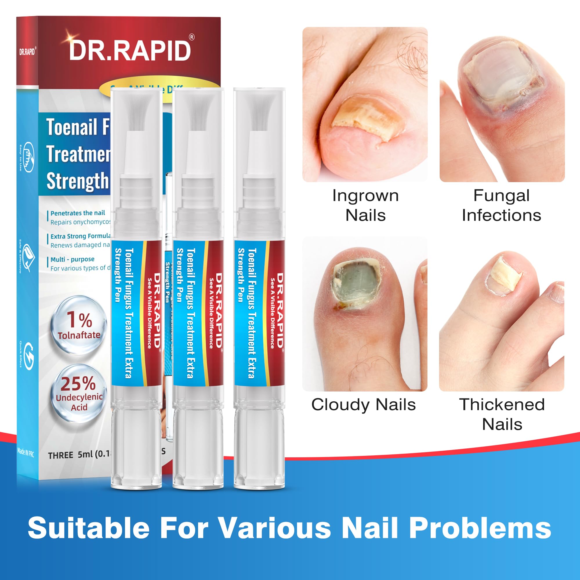 DR.RAPID Toenail Fungus Treatment Pen Extra Strength – 25% Undecylenic Acid & Terbinafine (5ml, 3 Pcs)