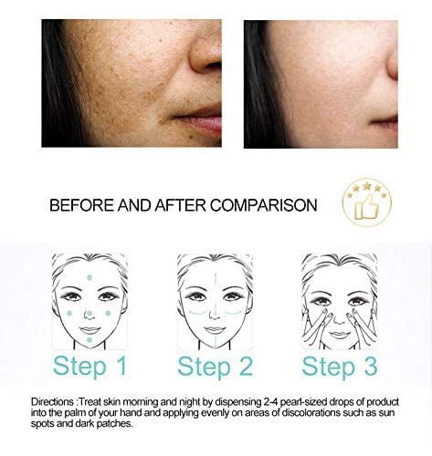 DR.RASHEL Fade Dark Spots Serum – Reduce Pigmentation, Softer, Clearer Skin • 1.69 oz