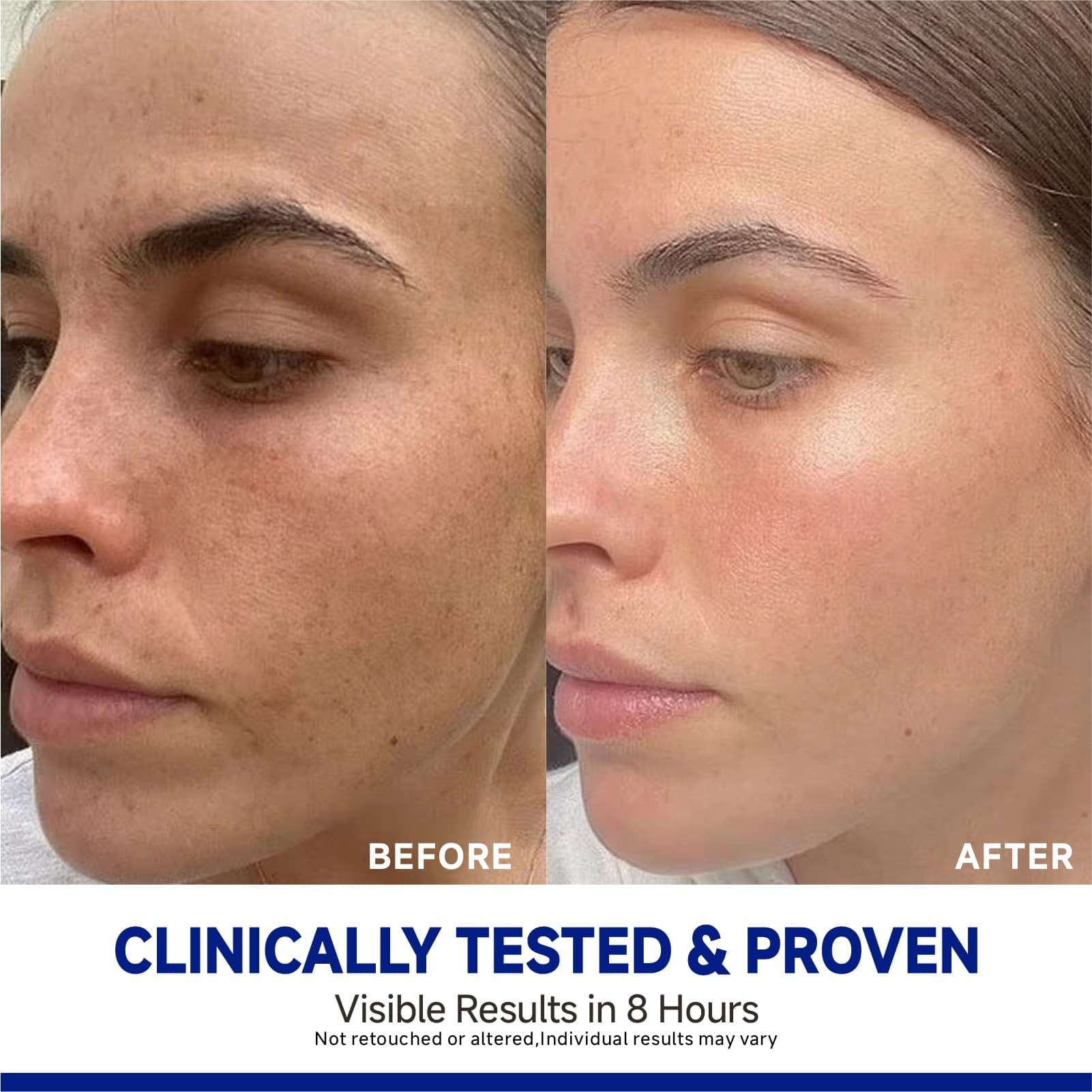 Dr Vincent Glass Glow Night Wrap Mask | Tetrapeptide-30 + Kojic Turmeric