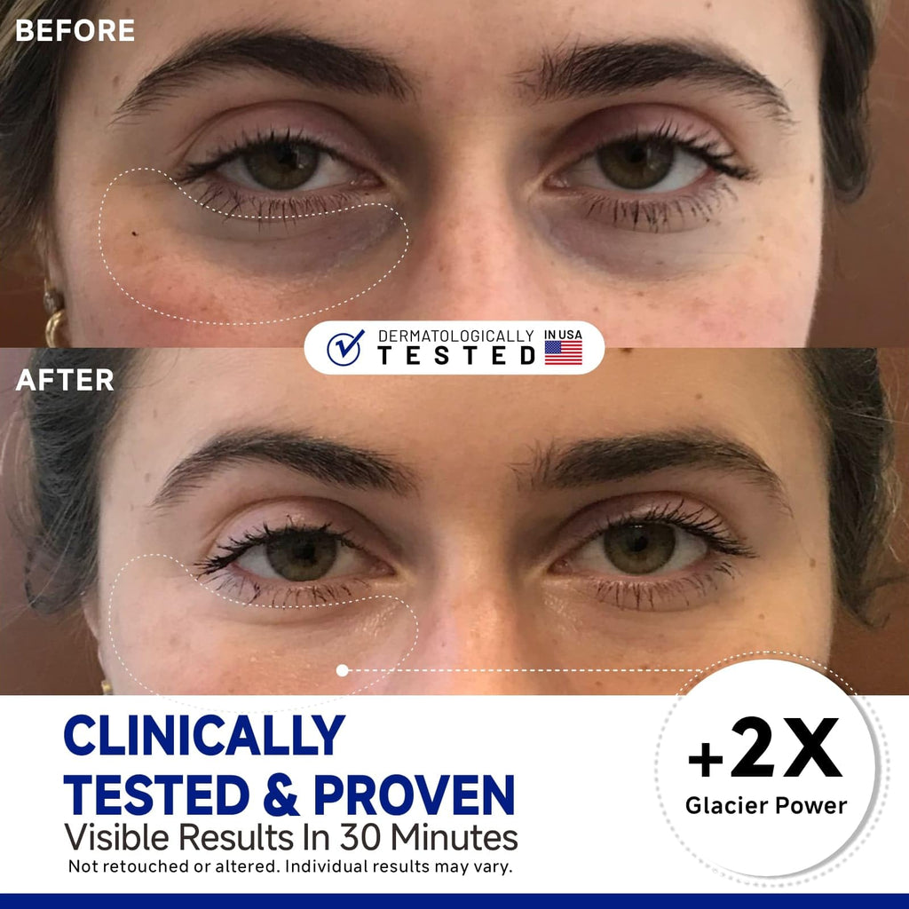 Dr Vincent Peptide Cooling Under Eye Patches — Soothing, Reduces Dark Circles & Puffiness, 60 Pairs