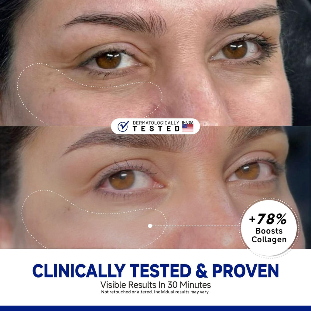 Dr Vincent Peptide Under Eye Patches – Firming, Reduces Dark Circles & Puffiness