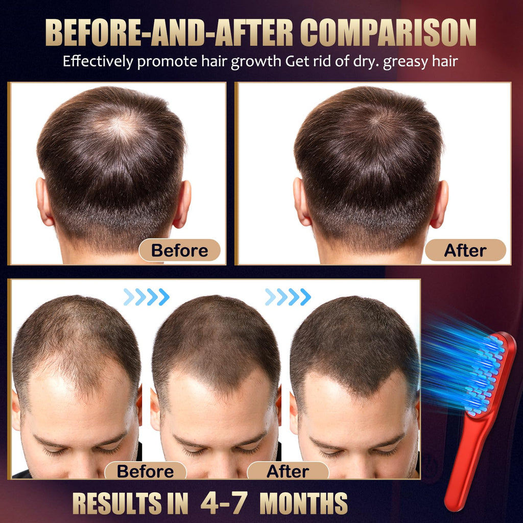 DREWALA Laser Hair Growth Comb A-803 | Red Light Hair Growth Device