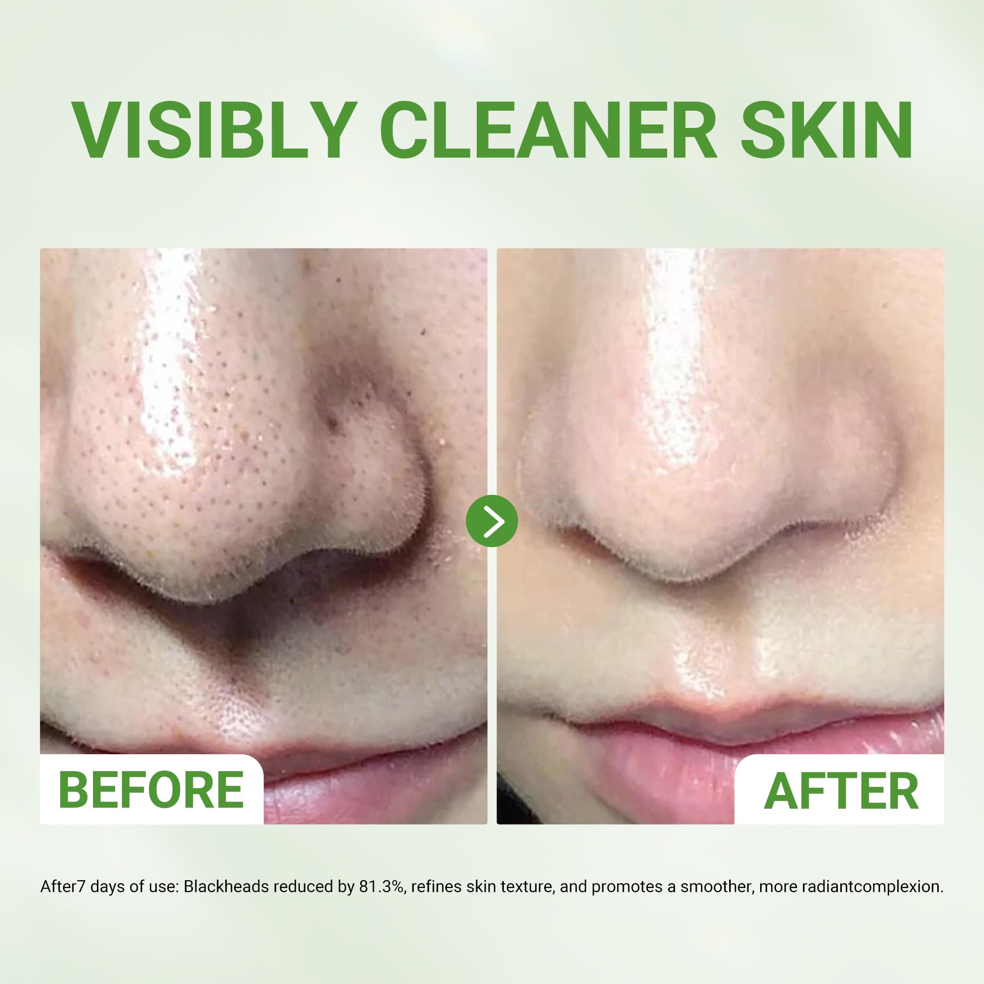 Dr.Leo Amazonian White Clay & Glacier Clay 3X Acid Mask – Deep Clean Pores