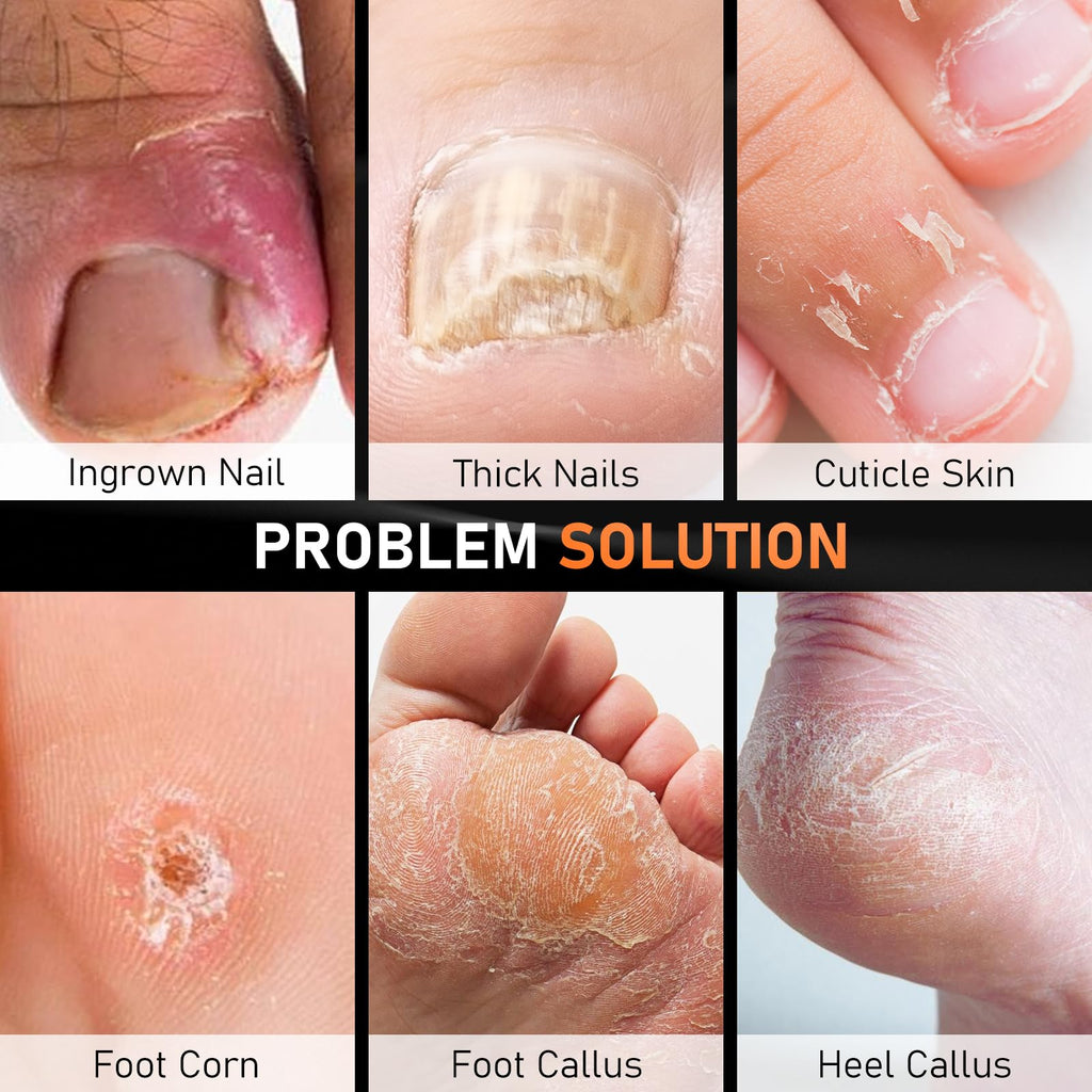 DRMODE 7-Piece Ingrown Toenail Removal Kit | Professional Pedicure Tools