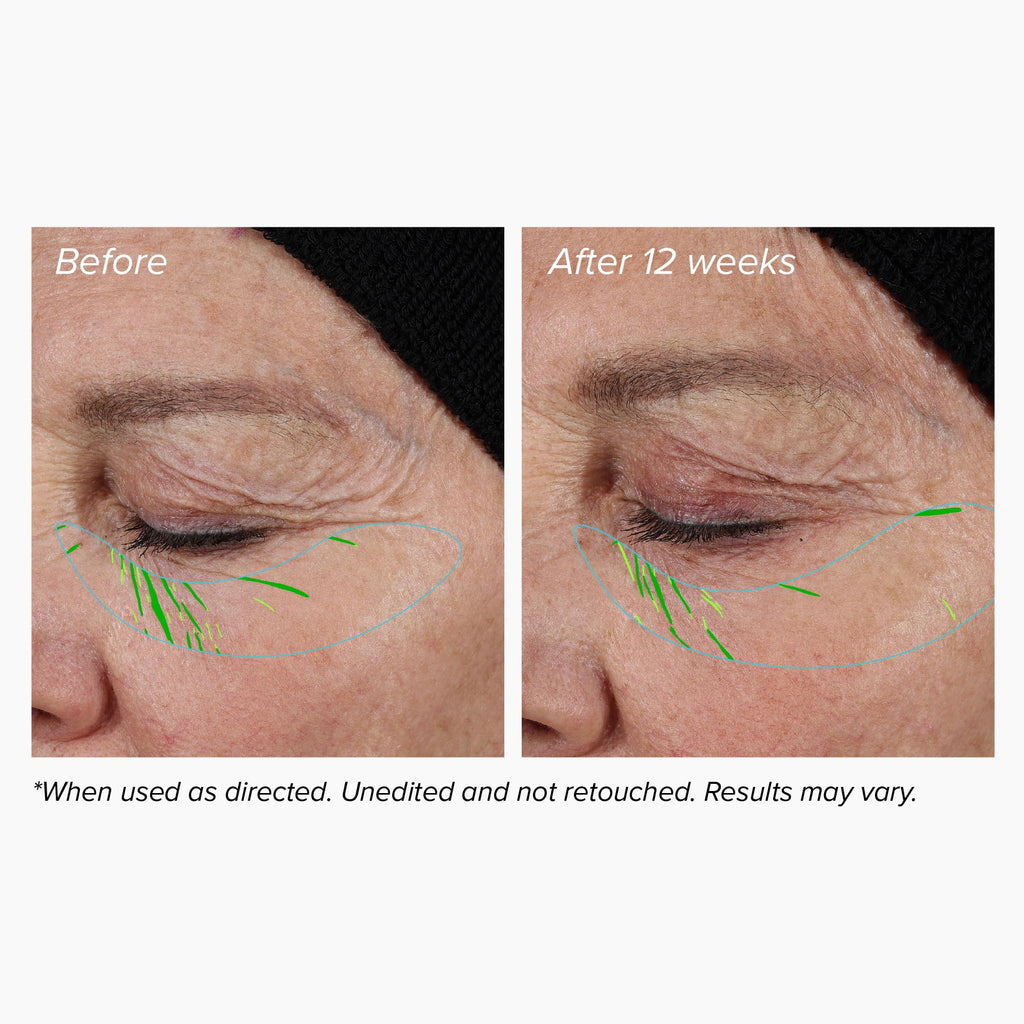 DRMTLGY Needle-less Growth Factor Serum | Multi-Peptide & Hyaluronic Acid for Firming