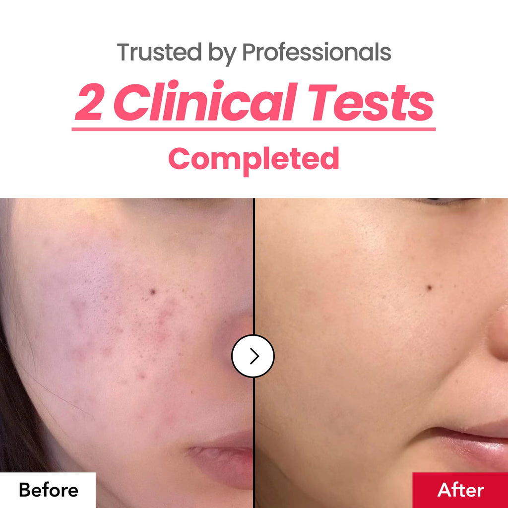 Dr.Percent Dark Spot 24% Correcting Pink Glow Cream — Tranexamic Acid 6%, Niacinamide 5%