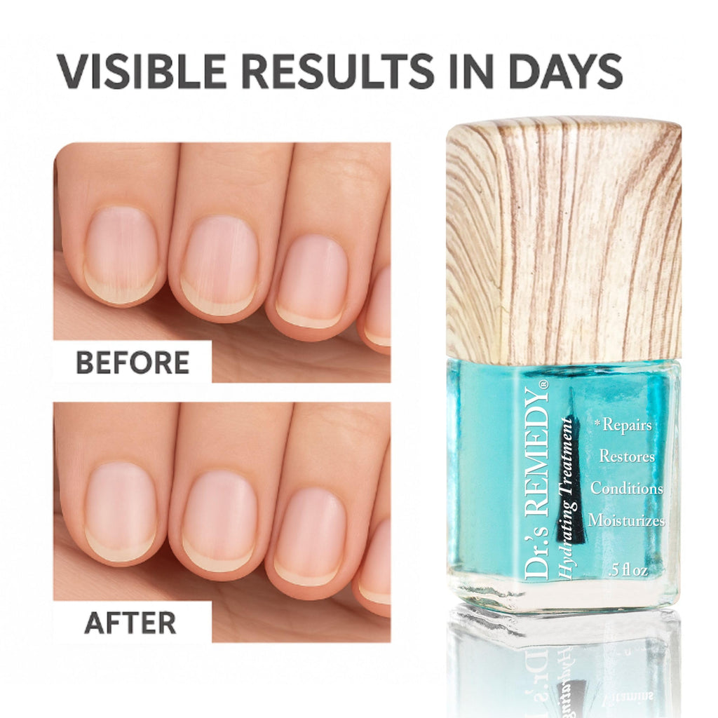 Dr.'s Remedy 3 Pack Nail Polish Treatment Kit – Restorative Remedy Trio, Non-Toxic Organic All-Natural Nail Care