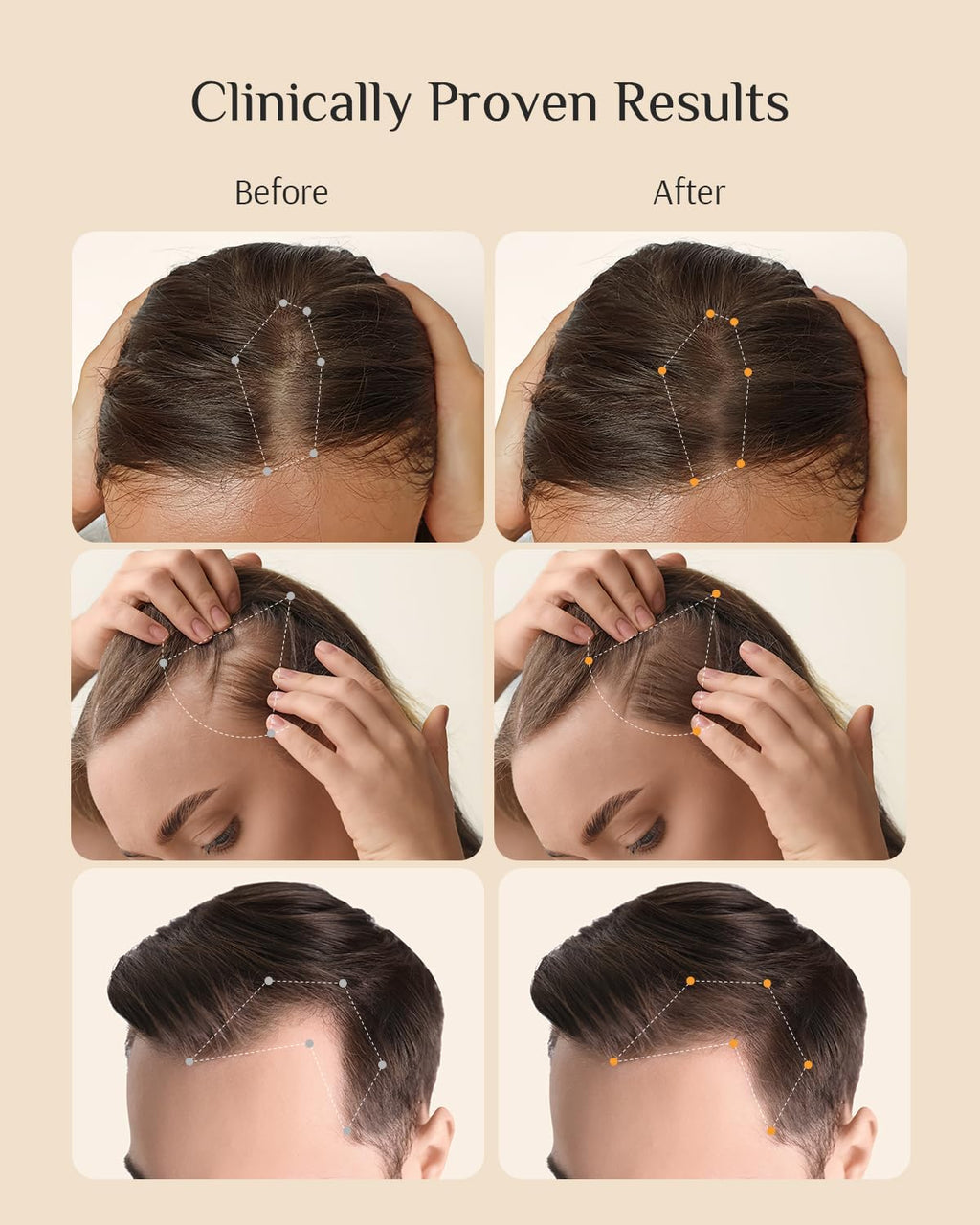 DR ZERO 3% Redensyl Hair Growth Serum for Women – 60ml