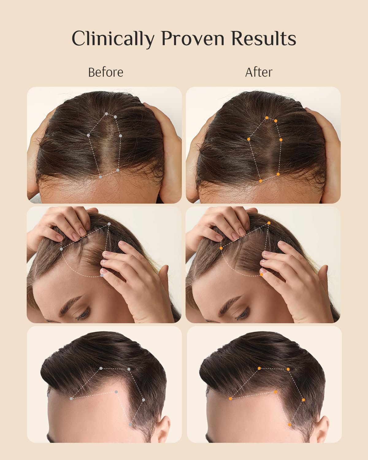 DR ZERO 3% Redensyl Hair Growth Serum for Women – 60ml