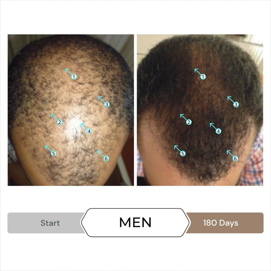 DS Laboratories Spectral Men’s Hair Density Serum & Spectral Booster — Leave-In Thickening Duo