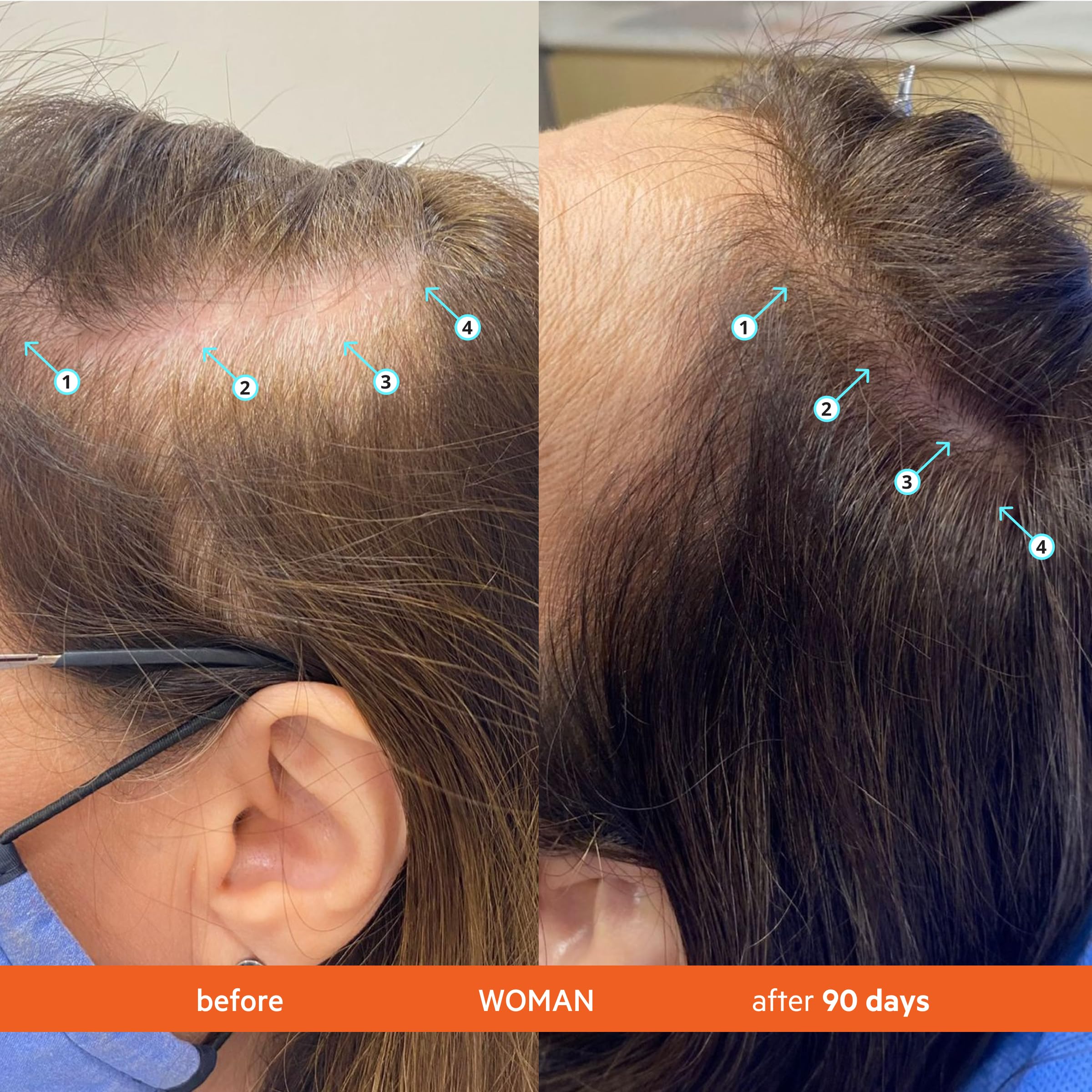 DS Laboratories Revita Shampoo & Conditioner Kit — Fuller-Looking Hair, Sulfate & Silicone Free