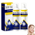 dssuoa ChillErase Bump Renewal Spray – Soothing Cooling for All Skin Types