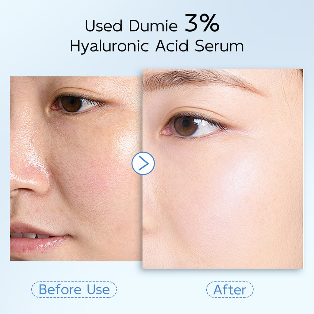 Dumie 3% Hyaluronic Acid Serum – 4-HA Hydration with Ceramide NP & Acetyl Hexapeptide-8