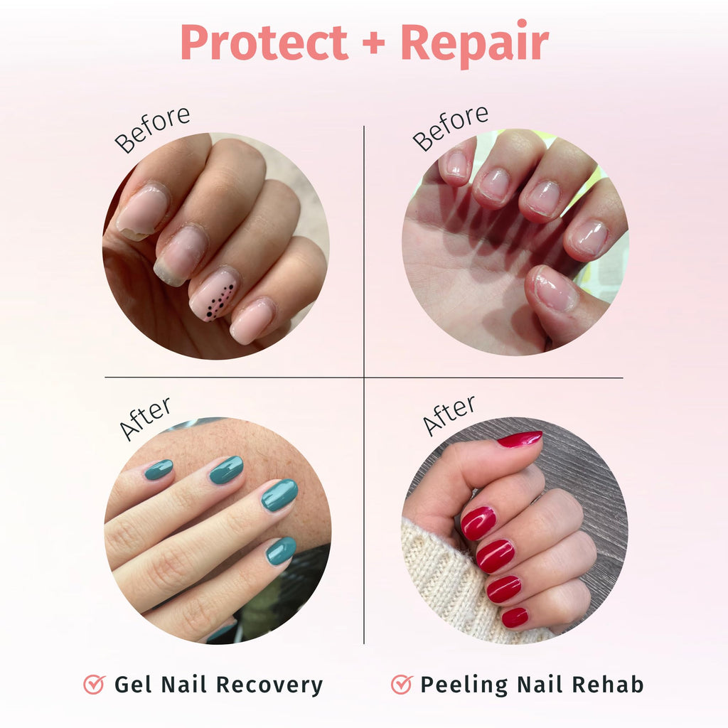 Duri Rejuvacote 1 Nail Growth System – Maximum Strength Nail Strengthener for Damaged Nails (0.45 fl oz)