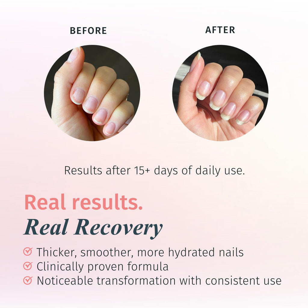 Duri Rejuvacote 1 Nail Growth System – Maximum Strength Nail Strengthener for Damaged Nails (0.45 fl oz)