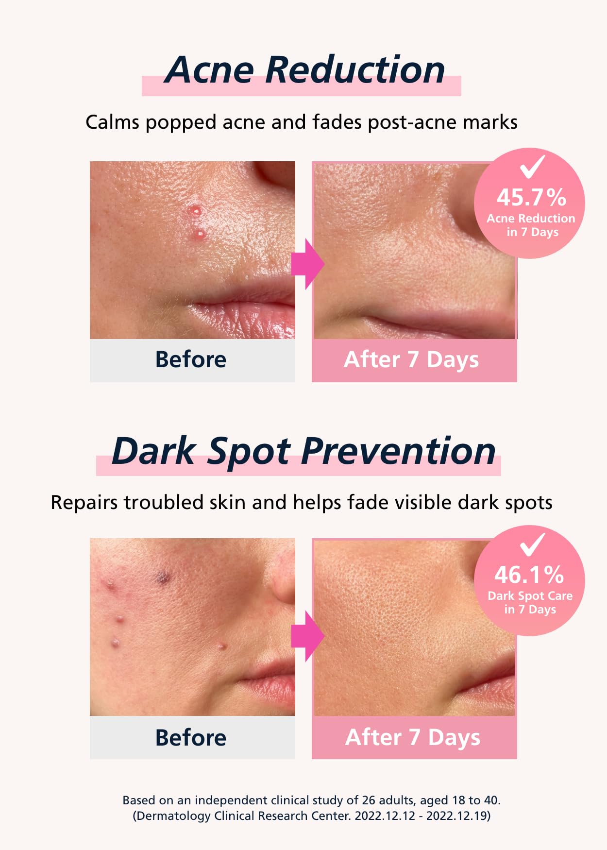 DWEasyDerm Easyderm Real Calming Patch Pimple Patches | Niacinamide, Hyaluronic Acid & EGF | 10 Packs (60 Patches) | K-Beauty Skincare
