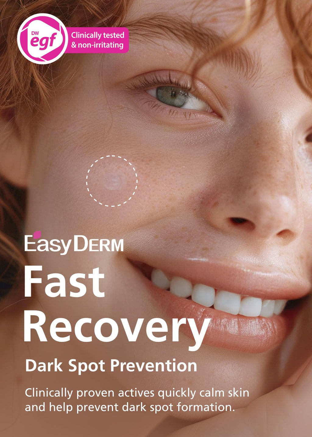 DWEasyDerm Easyderm Real Calming Patch Pimple Patches | Niacinamide, Hyaluronic Acid & EGF | 10 Packs (60 Patches) | K-Beauty Skincare