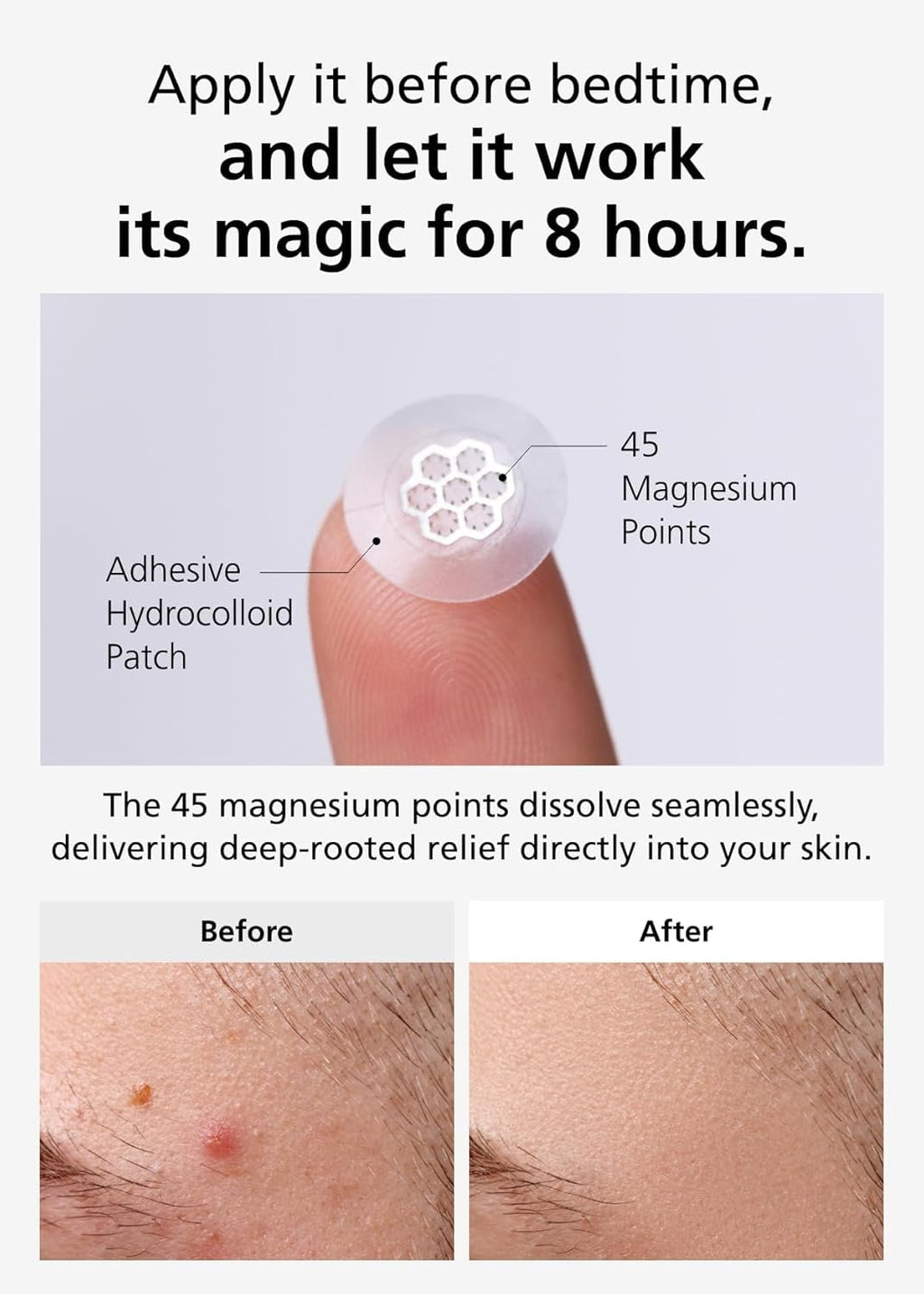 EasyDerm Quick Calming Magnesium Patches – 40 Patches (4 Pack) with Tea Tree & Cica | DWEasyDerm