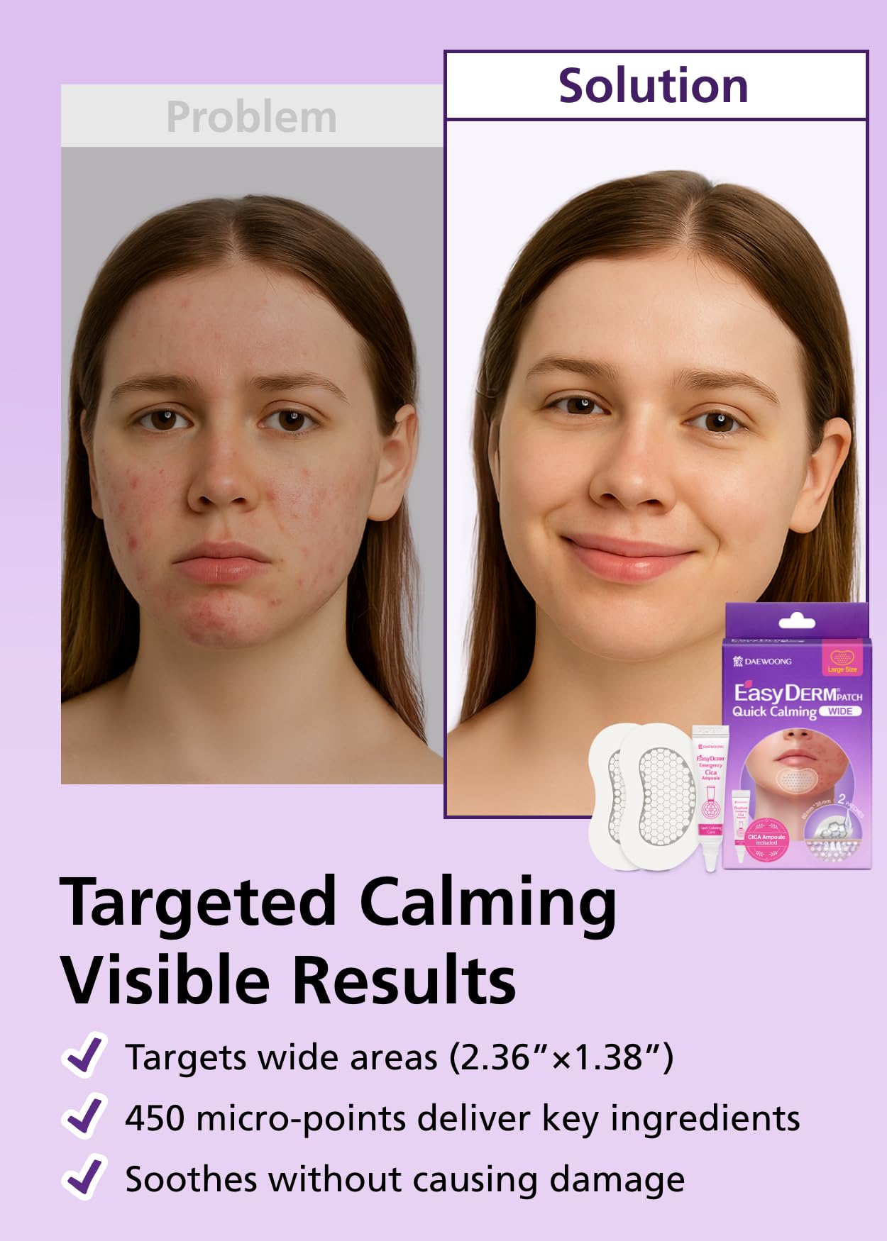 DWEasyDerm EasyDerm Quick Calming Magnesium Patches – Wide & Regular