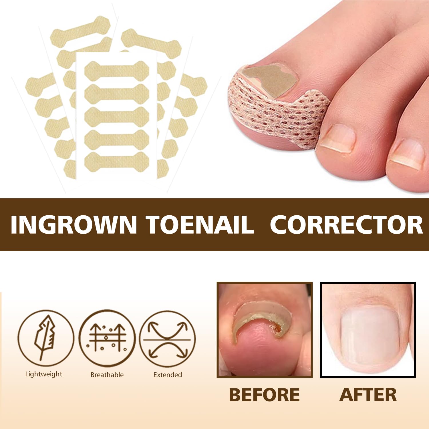 Dynaxor Ingrown Toenail Corrector Kit with Magnifier – Home Nail Care Tools