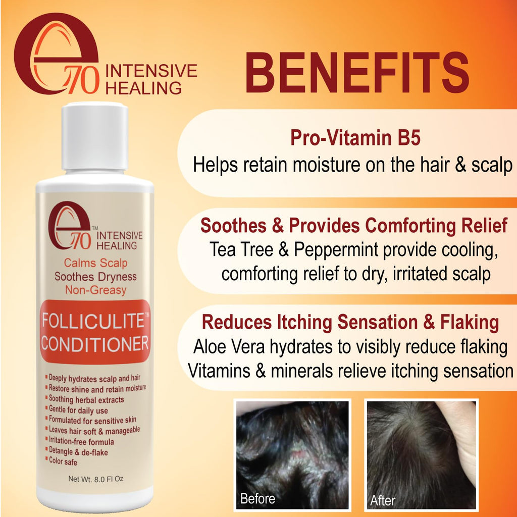 e70 Folliculitis Treatment Conditioner - 3% BHA, Tea Tree & Chamomile, 8 fl oz