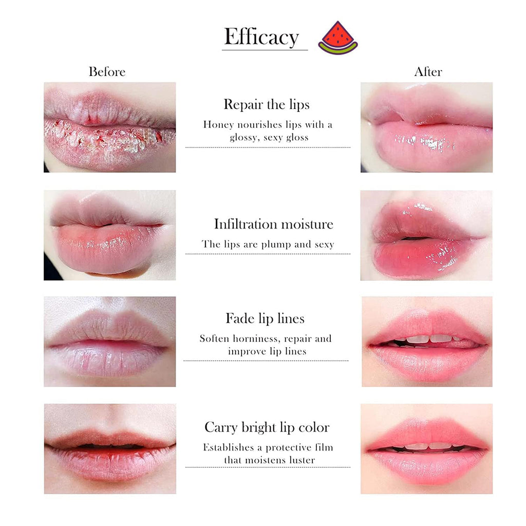 Eakroo 10-Piece Bee Lip Balm Honey Pot Set — Hydration & Shine