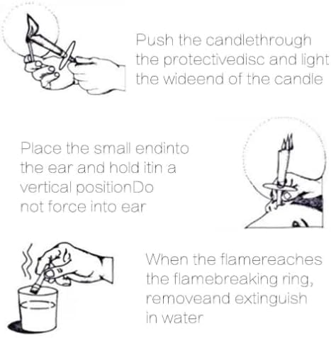 Ear Cleaning Kit – 10 Pcs Ear Wax Removal Tool Set for Home Use | Ergonomic & Complete