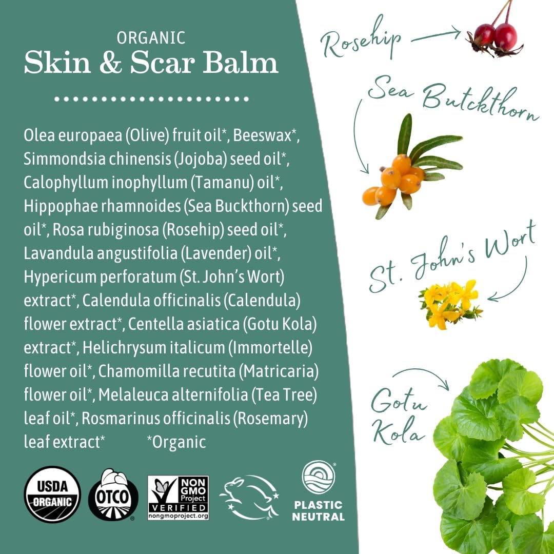 Earth Mama Organic Skin & Scar Balm | Postpartum Skin Care for Scar & Stretch Marks (2-Pack)