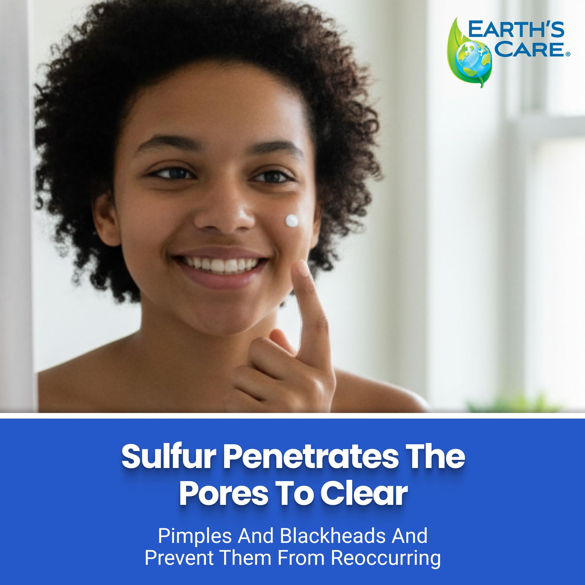 Earth's Care Acne Spot Treatment - 10% Sulfur Cream for Cystic Acne