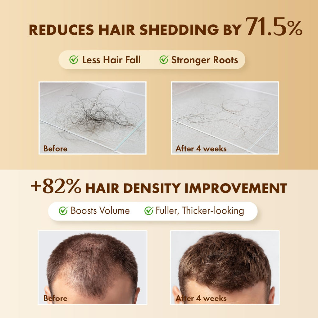 EarthShine Hair Growth Serum – Rosemary, Peptides & Caffeine