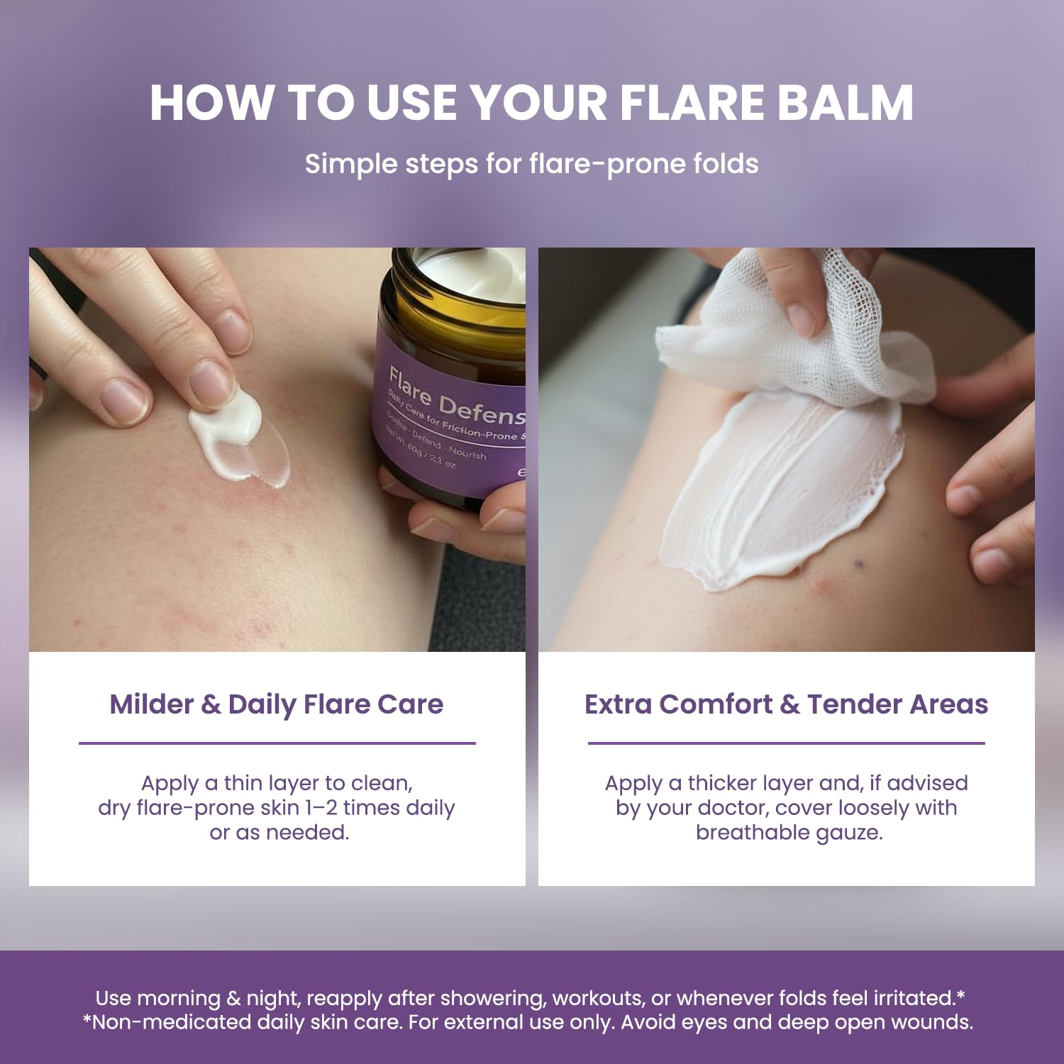 Easment Flare Defense Balm for Hidradenitis Suppurativa – 2 oz | Microsilver BG™ + Zinc Oxide