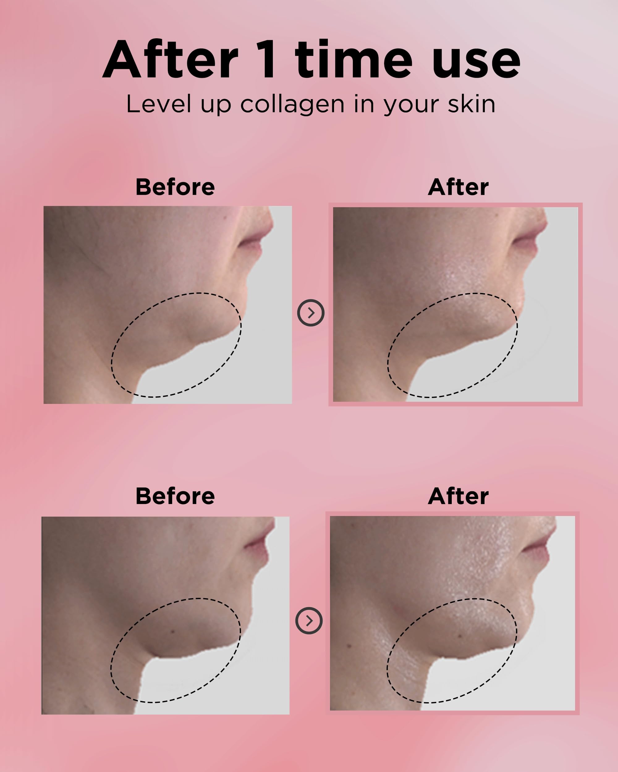 EASYDEW DW-EGF 55% Collagen Silkream Ampoule – Korean Serum for Firmness & Elasticity
