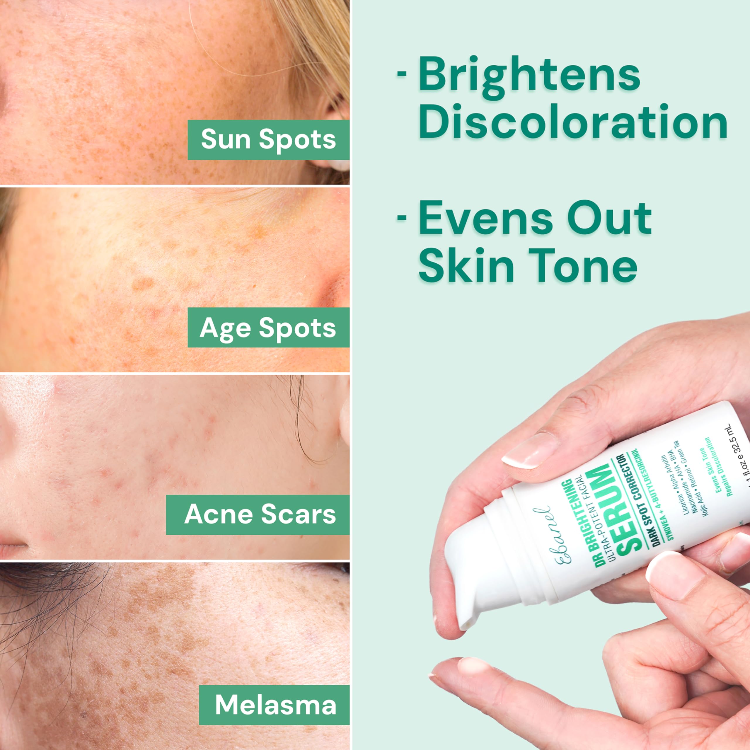 Ebanel Dark Spot Remover for Face & Body – Brightening Serum with Synovea HR & Alpha Arbutin