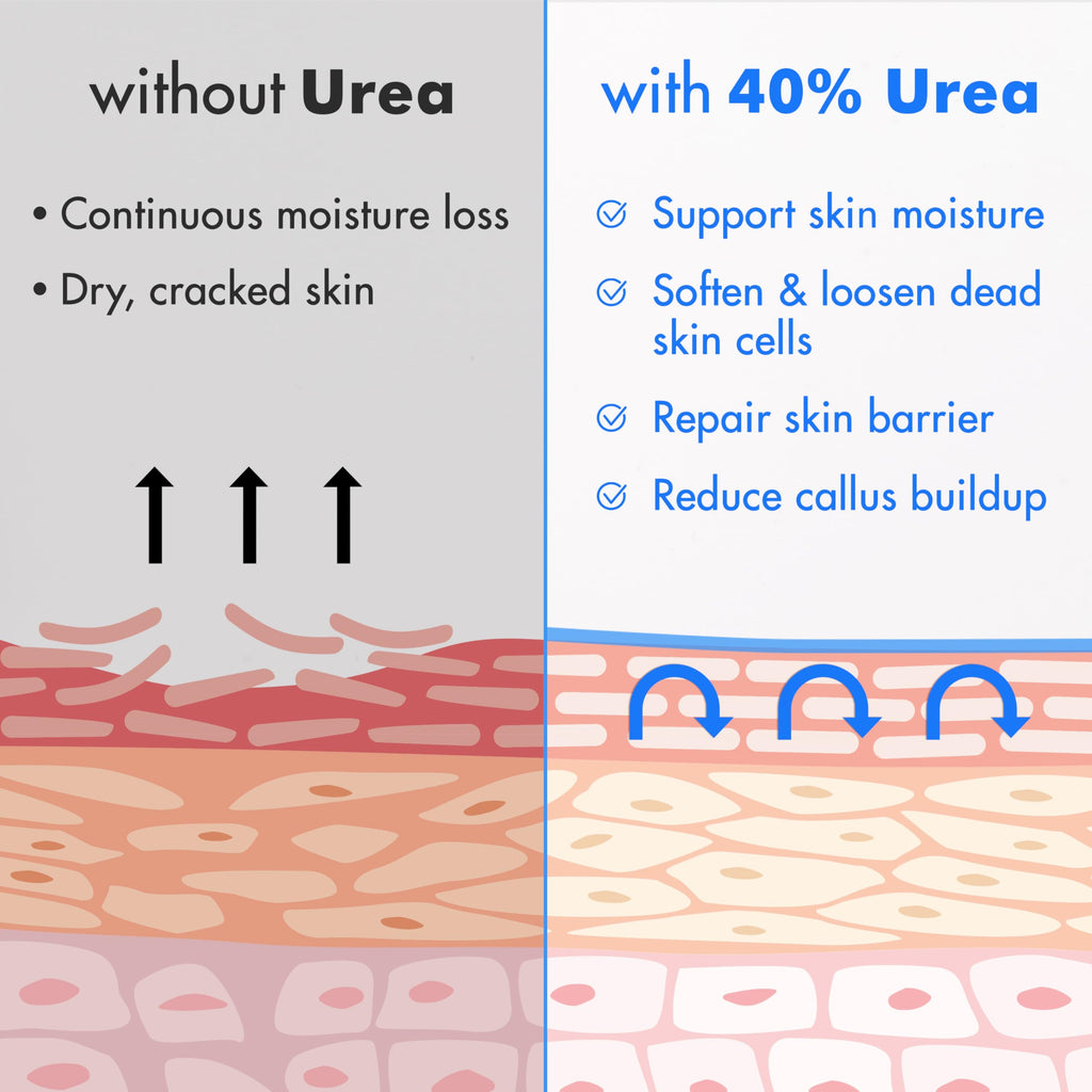 Ebanel Urea Cream 40% + 2% Salicylic Acid – Foot Cream for Dry, Cracked Skin (3-Pack)