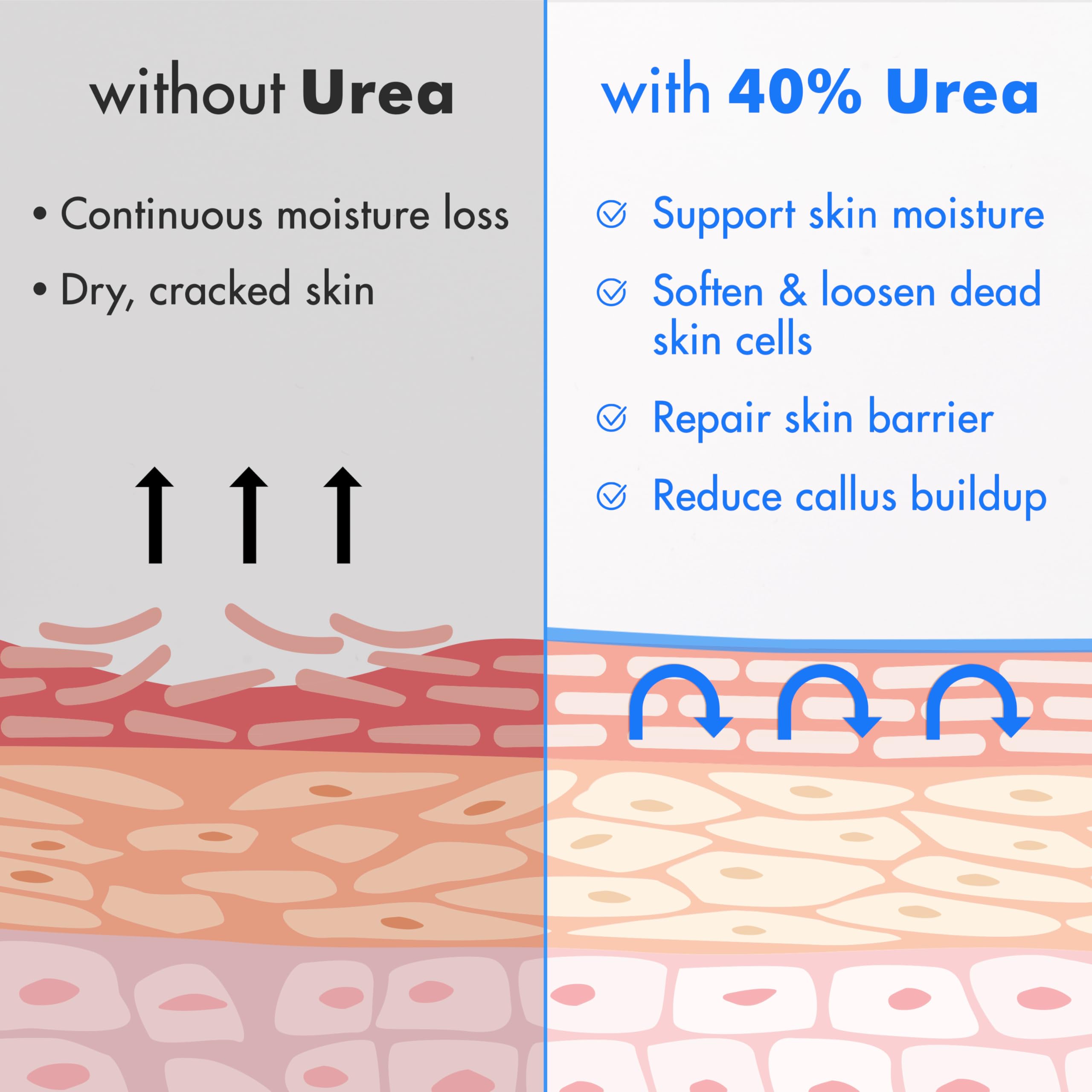 Ebanel Urea Cream 40% + 2% Salicylic Acid – Foot Cream for Dry, Cracked Skin (3-Pack)